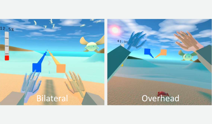 Two VR gameplay views labeled Bilateral and Overhead, with virtual hands reaching toward targets.